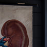 Vintage Anatomical Chart - Dresden: The Kidney-Anatomy Boutique-Anatomy Boutique