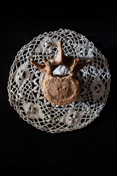 Antique human teaching bone - Lumbar Vertebra L2-Anatomy Boutique-Anatomy Boutique